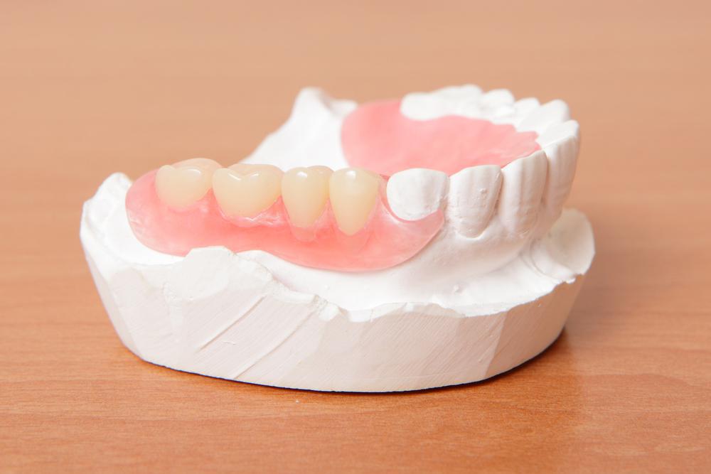 dentures that are made according to your needs